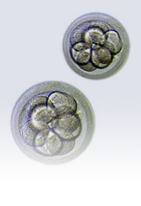 Image result for In Vitro Fertilization (IVF): What Is It?
