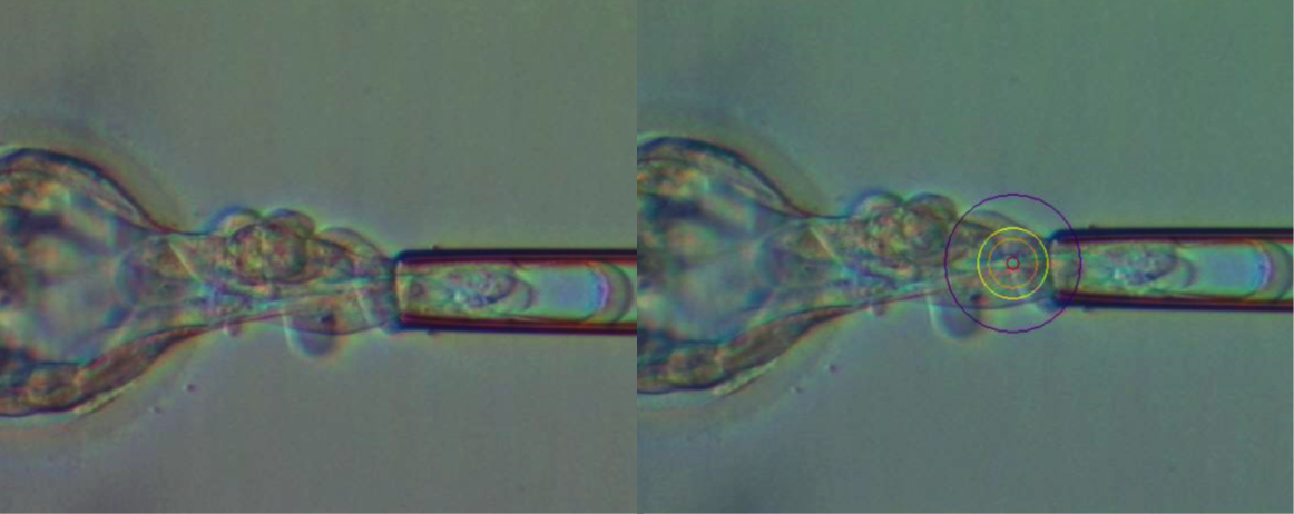 Day 5 and 6 Blastocyst Biopsy