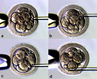 Assisted Embryo Hatching | O. Perelman and Cohen Center for Reproductive Medicine